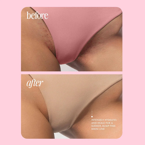 3-in-1 Bikini and body Hair Trimmer
