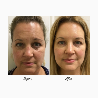 GHK-Cu Serum