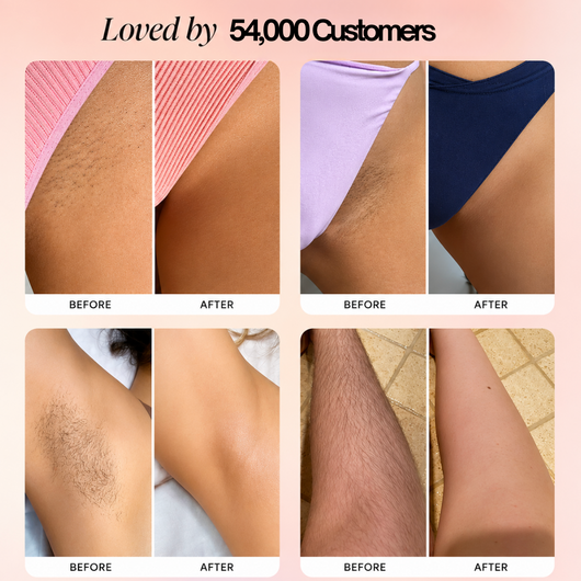 3-in-1 Bikini and body Hair Trimmer